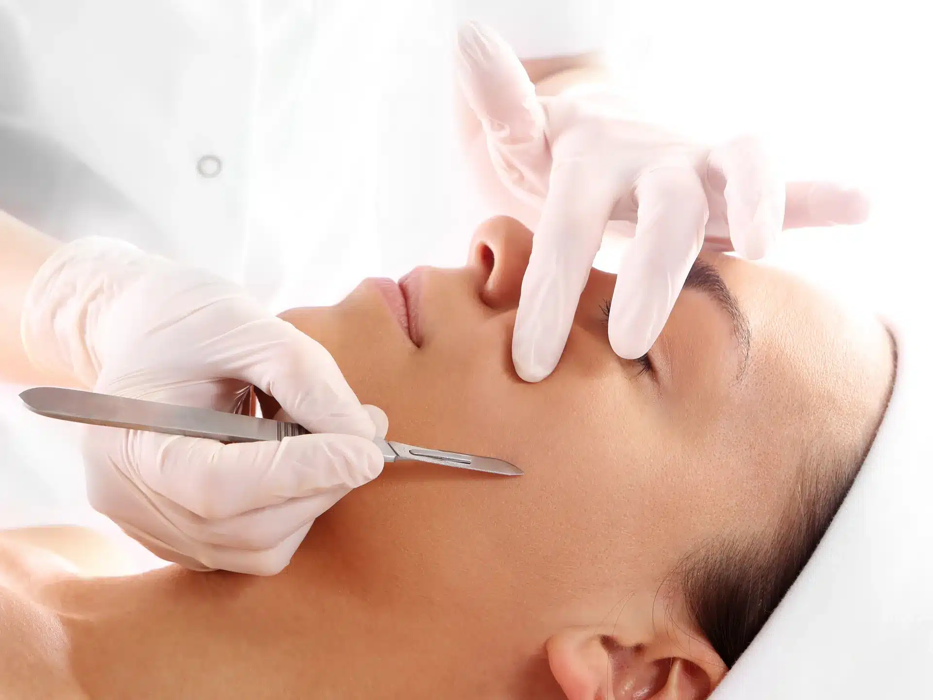 Microneedling